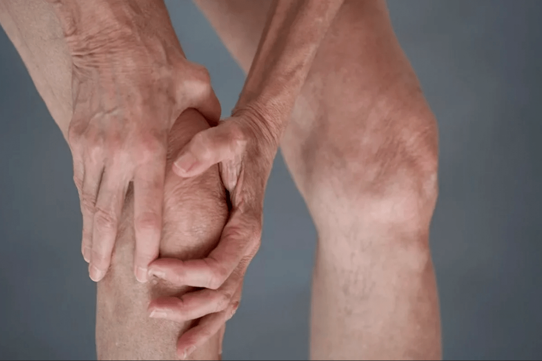 a dor nas articulacións pode ser a causa da artrose ou artrite