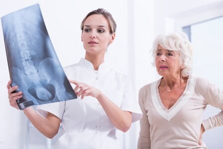 O exame de raios X é unha forma informativa de diagnosticar a osteocondrose da columna vertebral