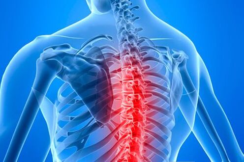 Columna vertebral torácica con signos de osteocondrose