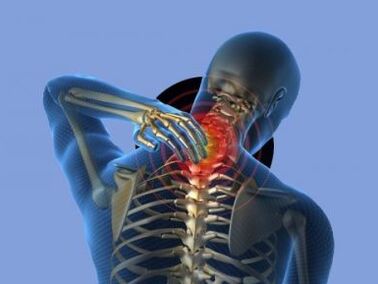 Unha persoa con osteocondrose da columna cervical está molesta pola dor no pescozo